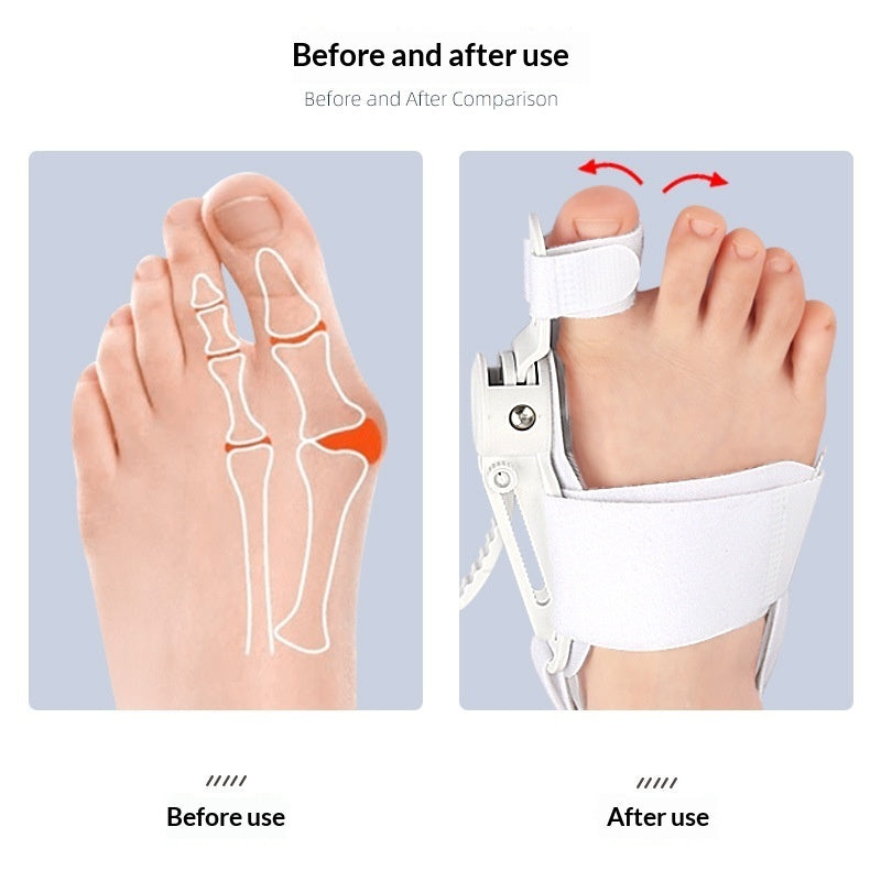 bunion corrector